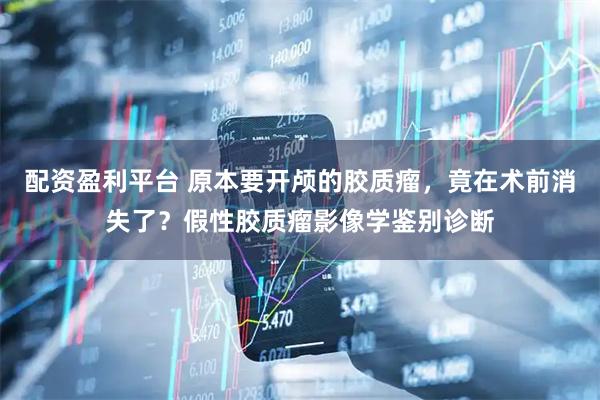 配资盈利平台 原本要开颅的胶质瘤，竟在术前消失了？假性胶质瘤影像学鉴别诊断